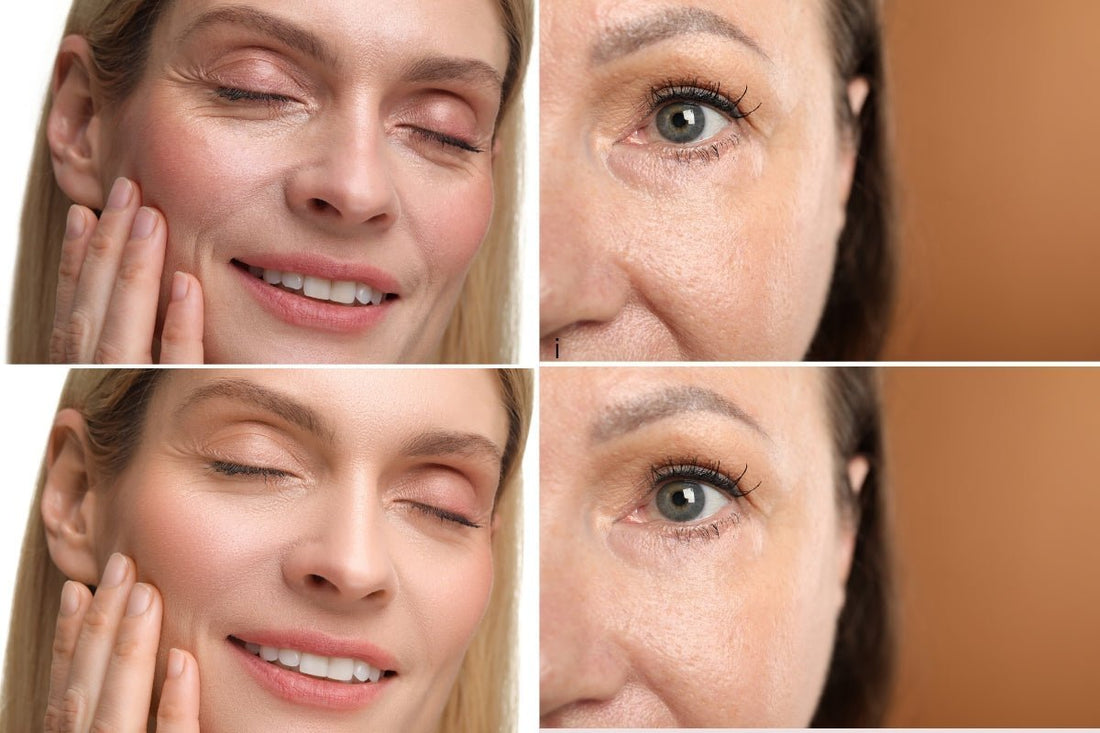 Best Collagen for Wrinkles - Lenovie